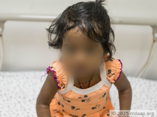 Harshini Needs An Urgent Liver Transplant To Survive A Fatal Disease
