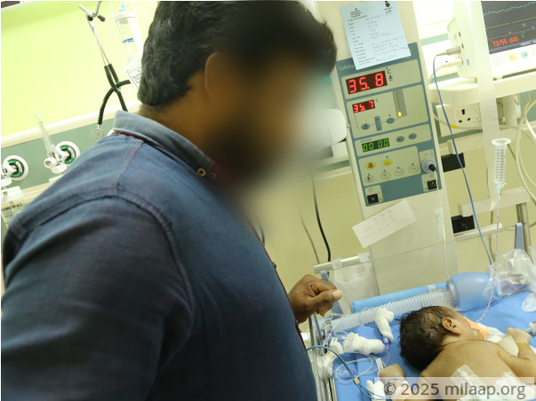 Unemployed For Almost A Month Now, Father Needs Help To Save His Baby