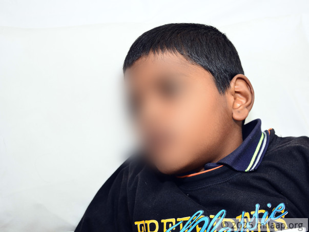 Mohit needs your help to undergo his treatment