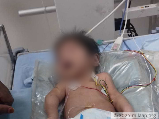 Baby of Sweta is in the ICU and needs your help to survive