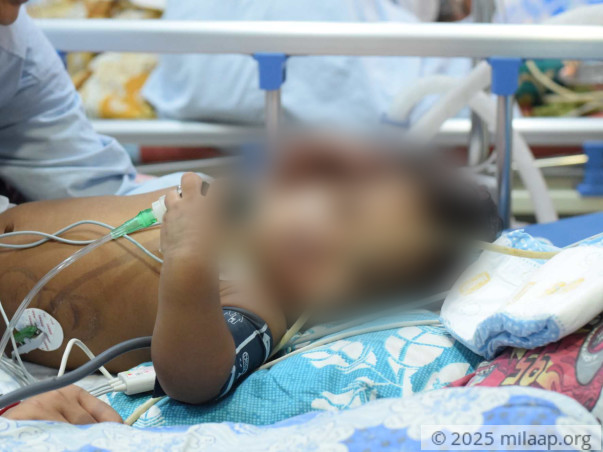 This Baby Spent His First Birthday In The ICU, His Lungs Are Failing