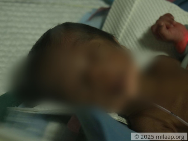 Help Our Twin Babies Recover