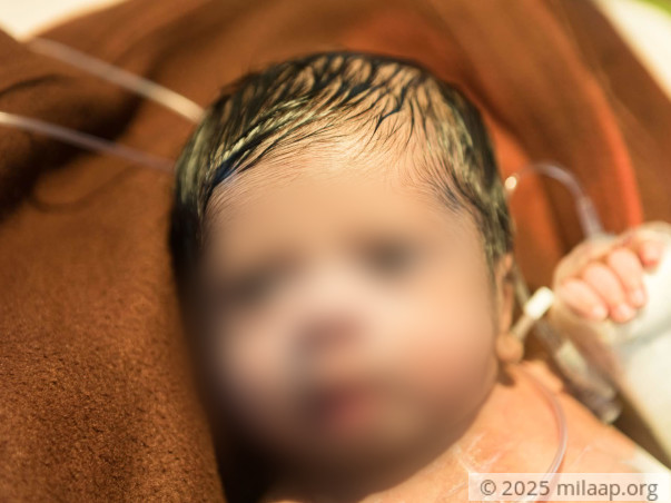 With A Scar Almost As Big As He Is, This Baby Is Struggling To Survive