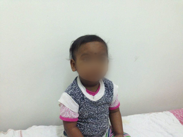 Help Baby Sana Fight Blood Cancer!