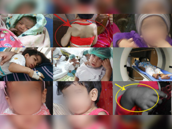 Help My Daughter Live #HelpSaveAvishi