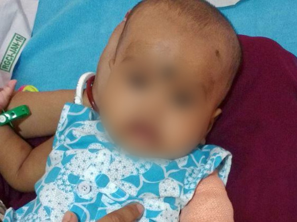 Help my 1-yr old niece undergo Bone Marrow Transplant to survive