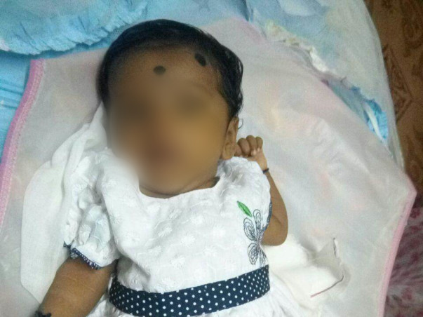 Help our 10-month-old baby girl undergo liver transplant