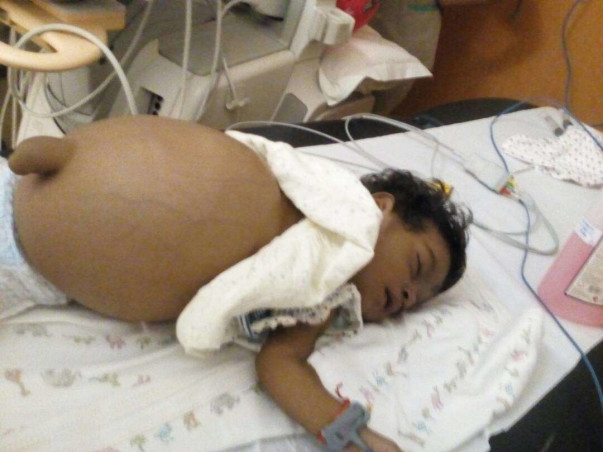 Help our 10-month-old baby girl undergo liver transplant