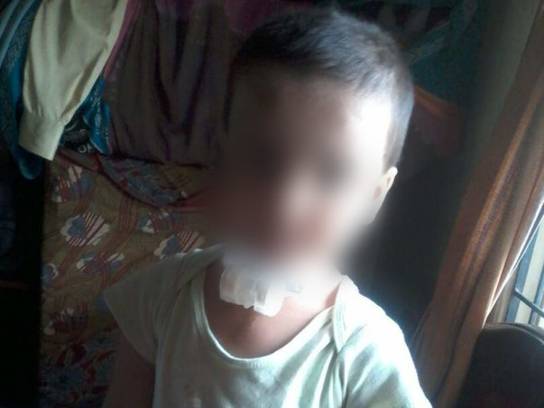 'Help Jathin fighting with major breathing problem'