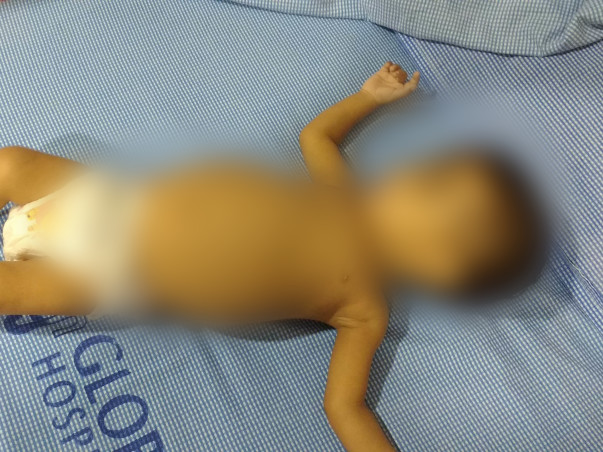 After Losing Two Babies, This Family Is Desperate To Save Their Child