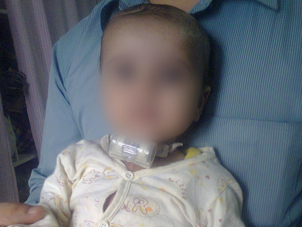 'Help Jathin fighting with major breathing problem'