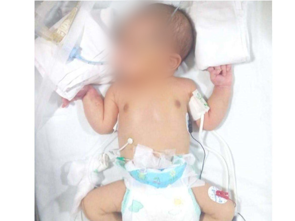 Save This Newborn Who Was Found Abandoned On The Road In Bengaluru