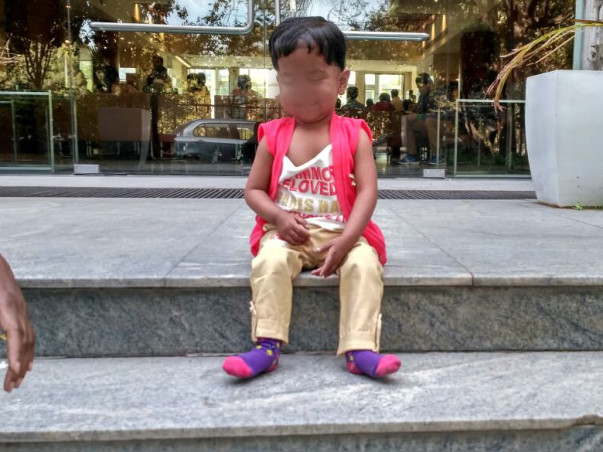 3-Year-Old Baby With Stunted Growth Because Of A Heart Defect