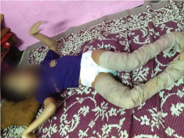 Help Ashifa To Overcome Her Physical Challenges