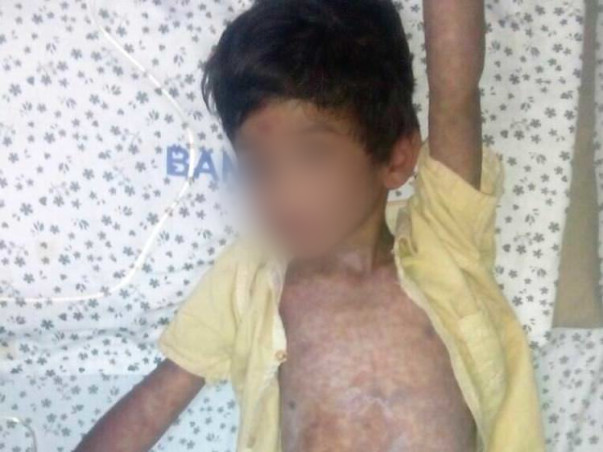 Help This 5-year-old With A Liver Abscess Who Is Screaming In Pain
