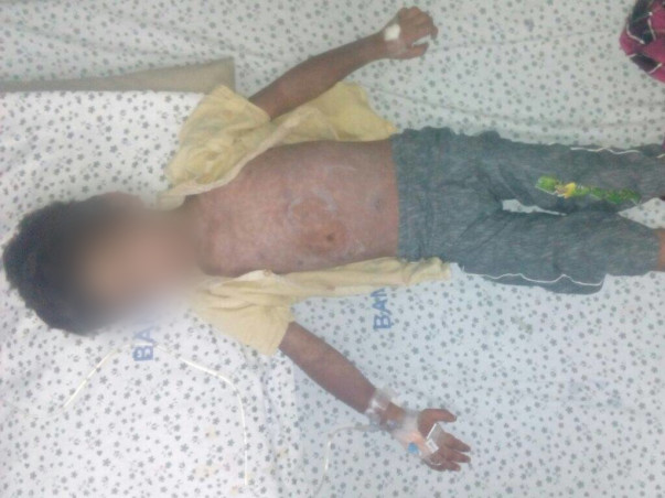 Help This 5-year-old With A Liver Abscess Who Is Screaming In Pain