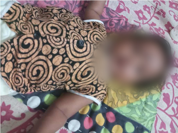 This 3-Month-Old Baby Girl Cannot Eat And Sleep, She Passes Blood