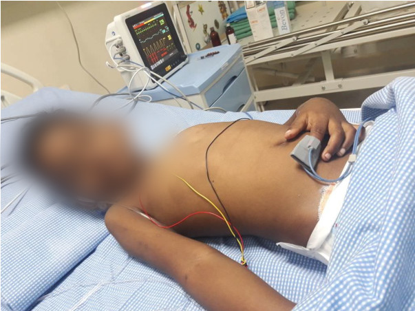 Urgent: 6-year-old Akhil Is In Severe Pain From Kidney Failure