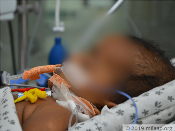 Help 5-month-old Who Had Seizures And Is The ICU With Brain Fever