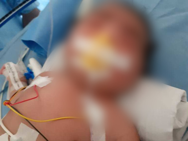 Help 4-day-old baby Undergo Surgery For Anorectal Malformation