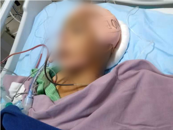 Help Lavanya Recover!