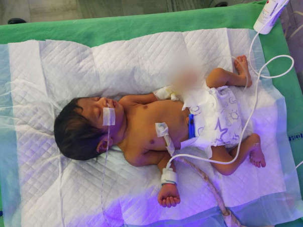 Support Me to Save My 6 Days Old Daughter, Who is in ICU.