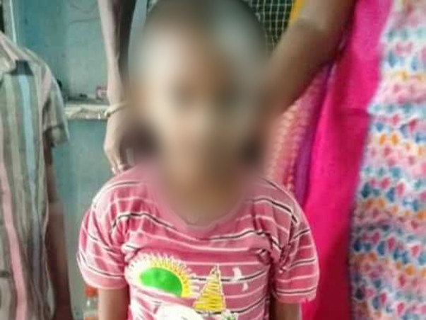 Help dhanush suffering from Bone Cancer