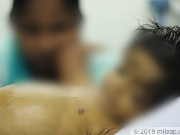 Help Magizhini Fight Biliary Atresia And Undergo A Liver Transplant
