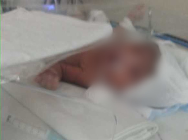 Help a Baby Girl to Survive and to see a Beautiful World...