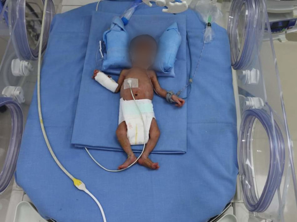 Poor And Helpless Mother Is Struggling To Save Her Twin Babies