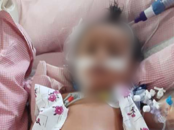 8 Months Old Mintu Needs Your Help Fight HLM secondary