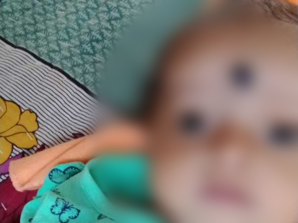 5 Months Old Baby Prapti Panda Needs Your Help Fight Osteopetrosis