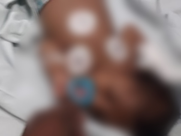 Help Baby Mallikarjun 2 months old diagnosed with end state liver disease