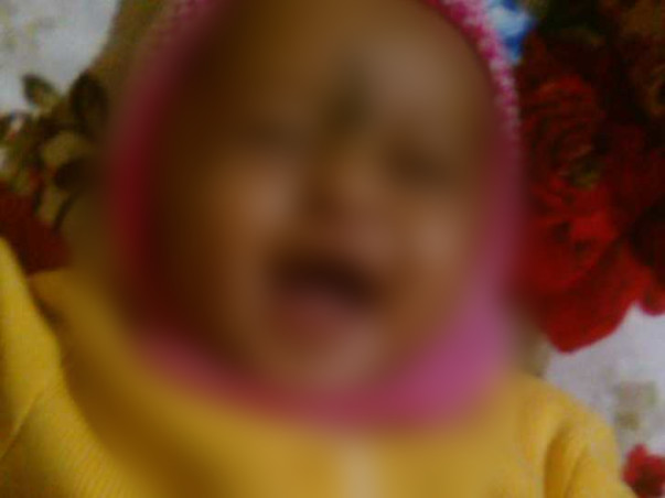Without Your Help, This Baby Could Lose His Sight Just Like His Father