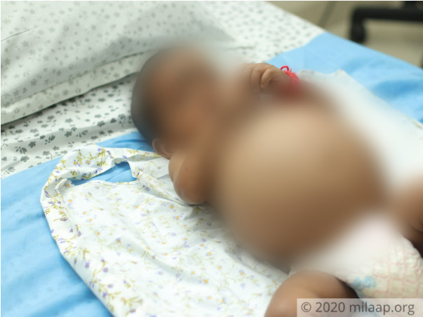 10-Month-Old’s Stomach Has Swollen To The Size Of A Balloon