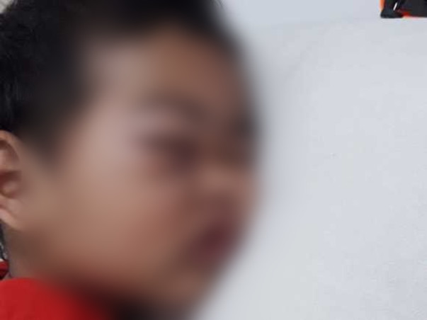 2 Years Old Ridip Karmakar Needs Your Help To Fight For Malignant Cancer