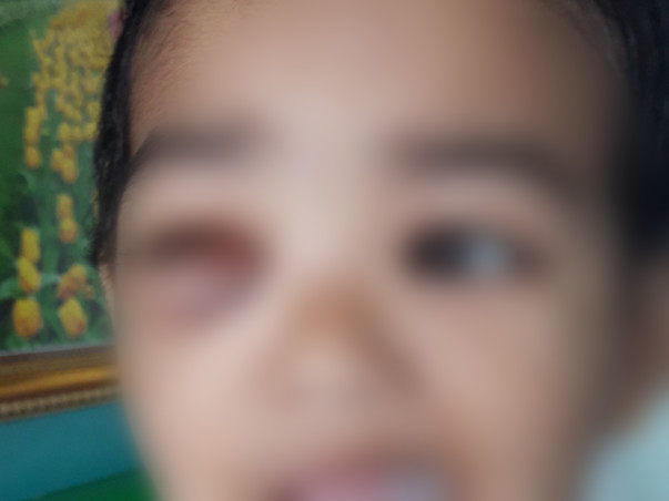 2 Years Old Ridip Karmakar Needs Your Help To Fight For Malignant Cancer