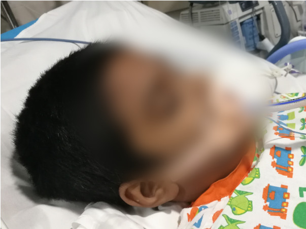 My 10 Years Old Son Is Struggling With Guillain-barré Syndrome, Help Him
