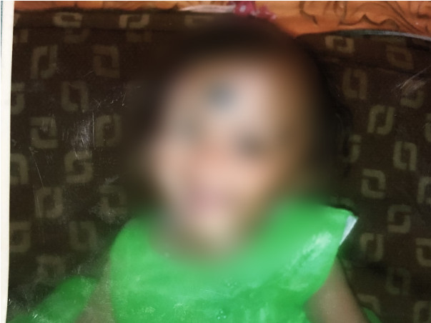 1 Year Old Khusi Needs Your Help To Fight Thalassemia major