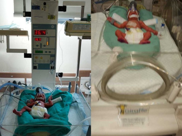 My Twin Babies Needs Your Urgent Support To Undergo NICU Care