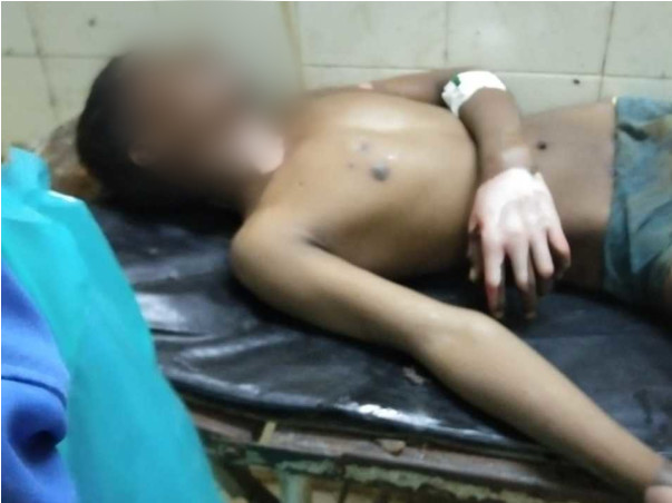 Support Sameer Recover From Electricity Burn