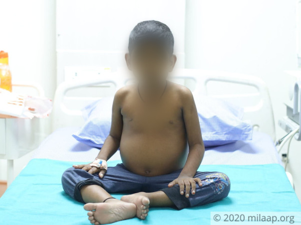 6-Year-Old Might Not Make It Without An Urgent Liver Transplant