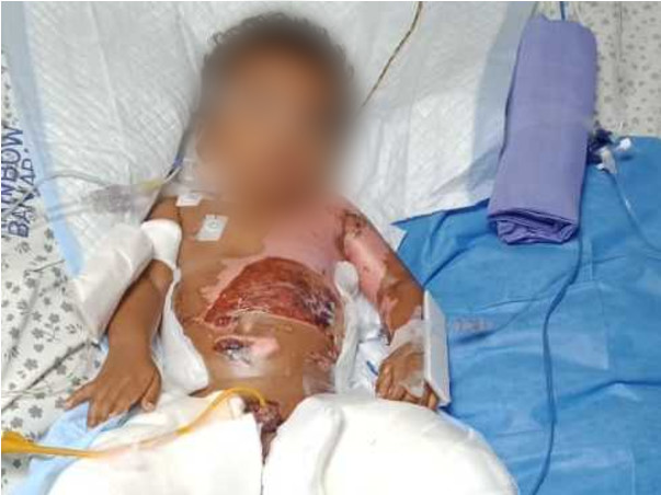 My son is in the ICU battling for his life and needs your help