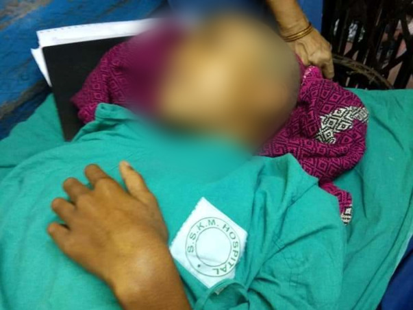 Help Aparna for life saving treatment of her brain tumor