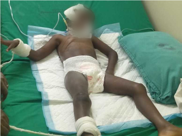Help 4 Years Old Lakshan Undergo Brain Surgery
