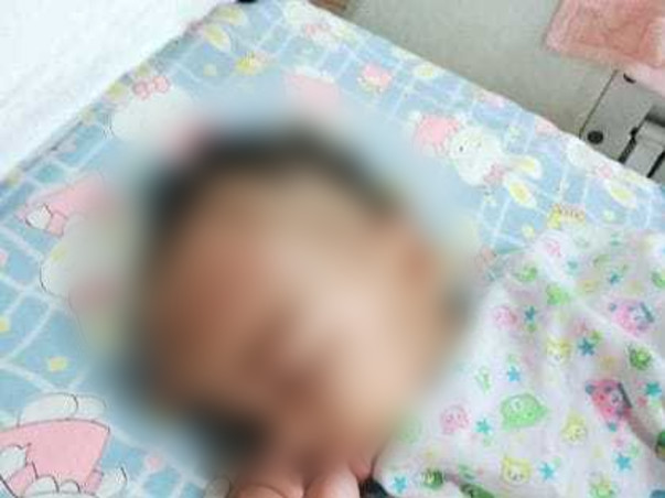 Help Deepa Sathish's 2-year-old Son Midhun Fight Brain Tumor (ATRT)
