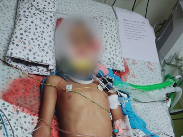 Help Sravan Recover Head Injury And Neurological Shock
