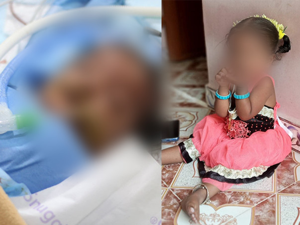 Help my 2 years old daughter to fight Heart Problem -ECMO Care