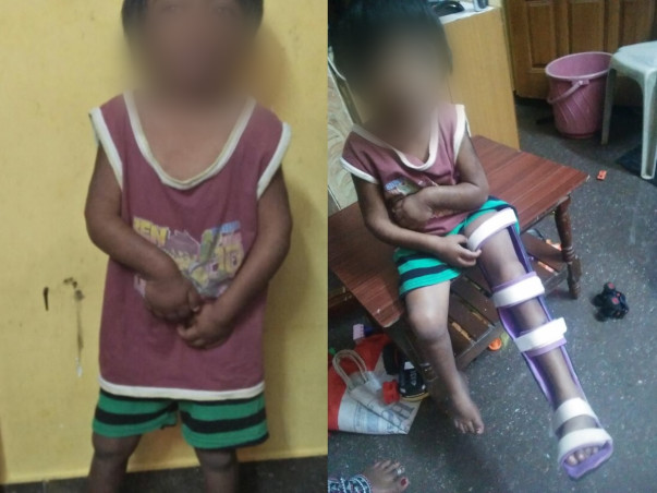 Support Druthi Recover From Mucopolysaccharidosis