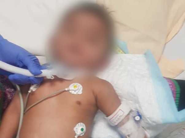 9 Months Old Baby Of Shruthi Needs Your Help Fight Pierre Robin Sequence